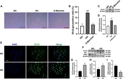 C1q/TNF-Related Protein 9 Attenuates Atherosclerosis by Inhibiting Hyperglycemia-Induced Endothelial Cell Senescence Through the AMPKα/KLF4 Signaling Pathway